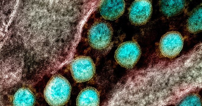 El SARS-CoV-2, el coronavirus causante de la pandemia mundial COVID-19, utiliza una proteína llamada polimerasa para replicar su genoma de ARN dentro de las células humanas infectadas. (Especial)